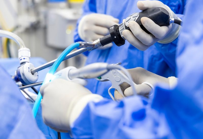 Arthroscopic-Shoulder-Surgery