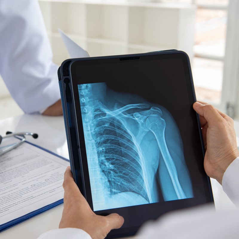 What-Does-a-Shoulder-Specialist-Do